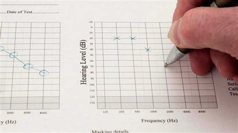 hearing test katikati